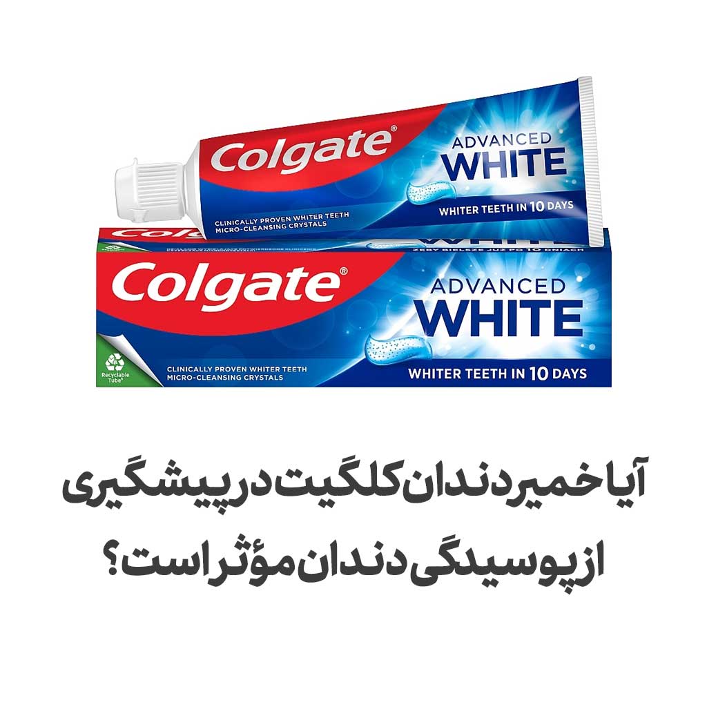 آیا خمیر دندان کلگیت در پیشگیری از پوسیدگی دندان مؤثر است؟