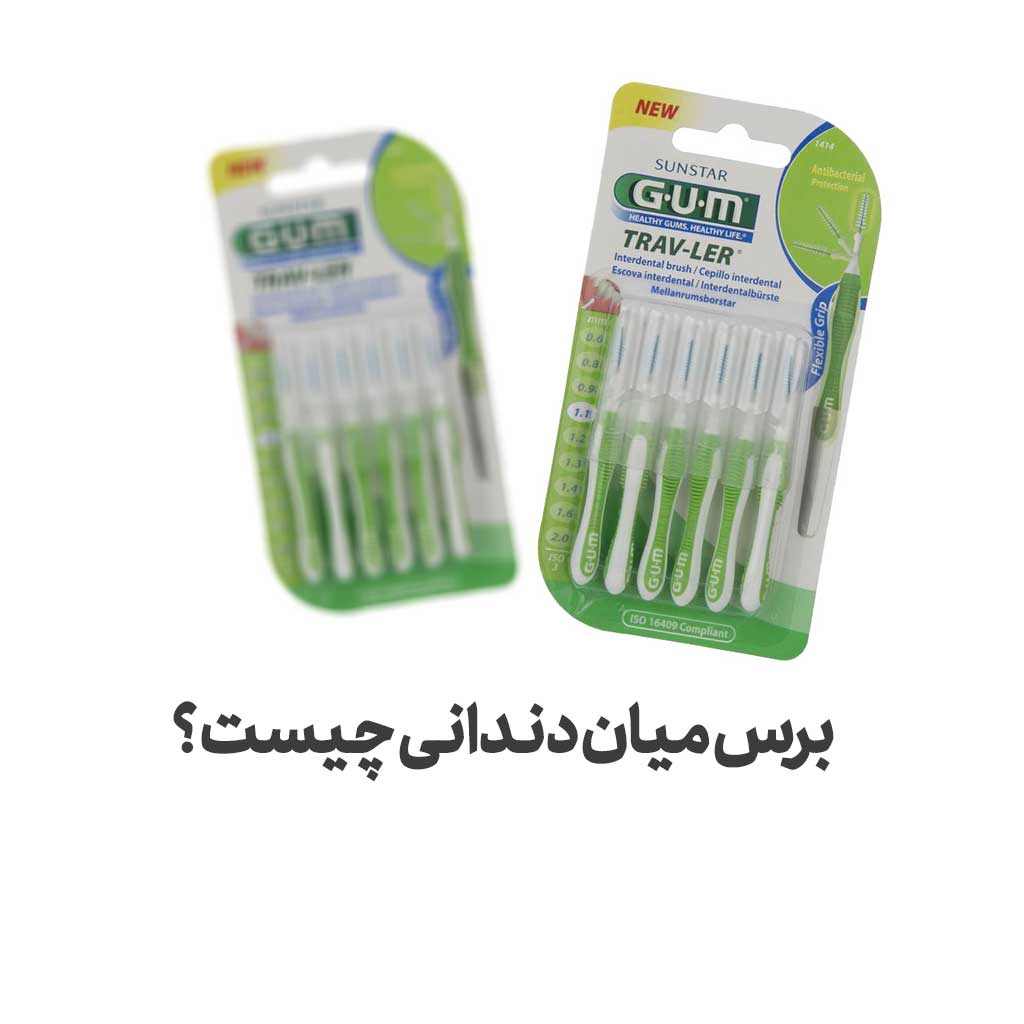 برس میان دندانی چیست ؟