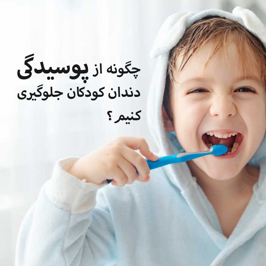 چگونه از پوسیدگی دندان کودکان جلوگیری کنیم؟