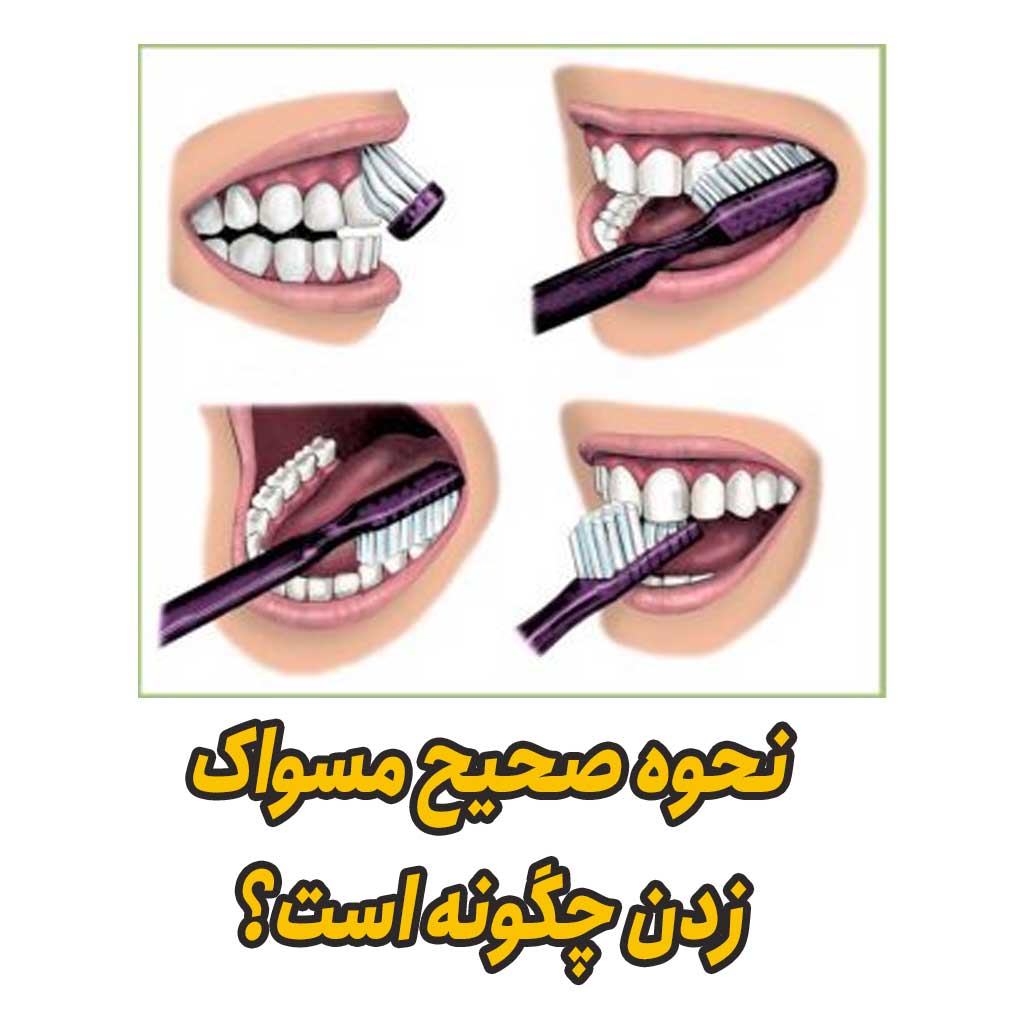 نحوه صحیح مسواک زدن چگونه است؟